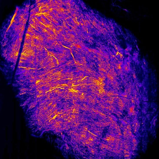 Fire Coronary Veins