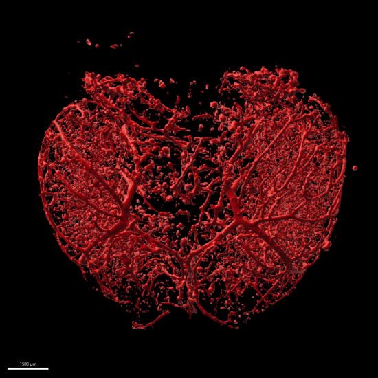 The broken heart brain