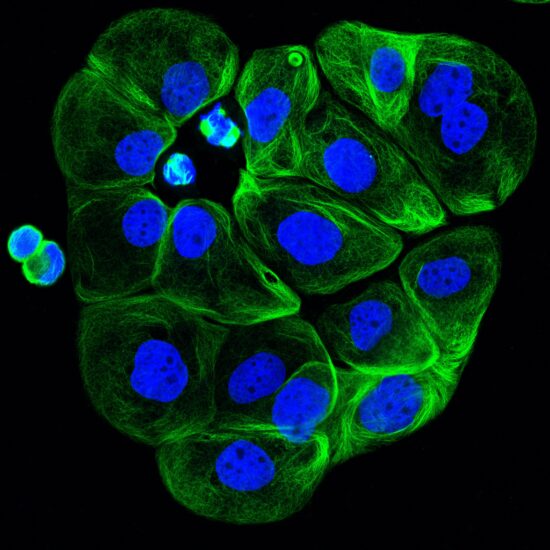 Tubulin croissant structures